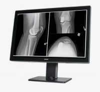 Barco Coronis Fusion 4MP MDCC-4430