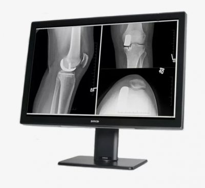 Barco Coronis Fusion 4MP MDCC-4430
