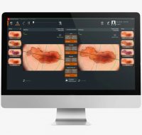 FotoFinder Moleanalyser Pro