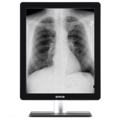 Barco Coronis 5MP LED MDCG-5221