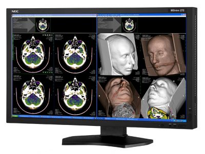 NEC MDview 272